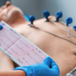 ECG Test Price
