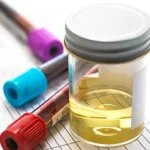 Amyloidosis guide diagnosis 722x406