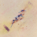 Istockphoto 455614457 170667a