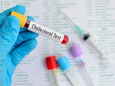 cholesterol