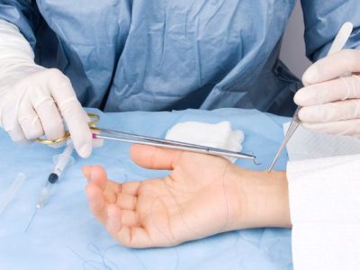 minor surgical